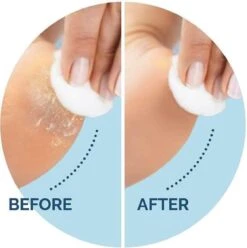 Scholl Velvet Smooth Voetvijl Wet & Dry - Starter - 1 Stuk 9 Scholl Velvet Smooth Voetvijl Wet & Dry - Starter - 1 Stuk -Cosmetica Serie Winkel 1196x1200 2