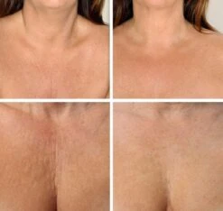 Simia™ Anti Rimpel Beauty Pads - Decolleté Large T Shape Set (2 Stuks) - Herbruikbaar Anti Aging Siliconen Pad Tegen Lijntjes En Slaaprimpels 11 Simia™ Anti Rimpel Beauty Pads - Decolleté Large T Shape Set (2 Stuks) - Herbruikbaar Anti Aging Siliconen Pad Tegen Lijntjes En Slaaprimpels -Cosmetica Serie Winkel 1200x1139