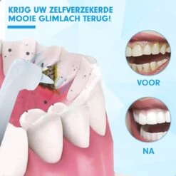 DEN-T® PRO P350 Elektrische Tandenpolijster - Wit - 5 Standen - 5 Opzetstukken - Polijstmachine - Polijstset - Tanden Polijsten - -Cosmetica Serie Winkel 1200x1200 422