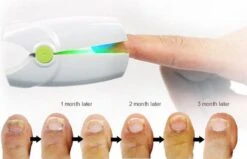 Anti Schimmelnagel Kalknagel Laserapparaat Om Zelf Te Behandelen, Veilig, Effectief, Snel En Pijnloos, Koude Laser Behandeling Voor Thuisgebruik, Voor Tenen En Vingers. Oplaadbaar. -Cosmetica Serie Winkel 1200x774